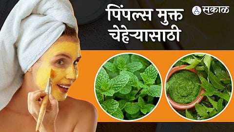 पिंपल्सपासून मुक्तता