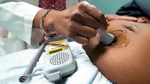 Minor Girl Abortion