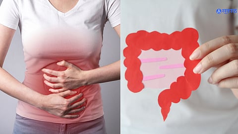 How To Keep Colon Healthy