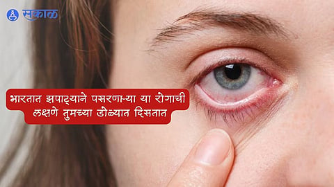 Diabetes Symptoms
