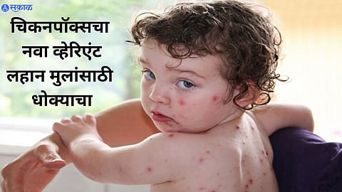 Chickenpox Clade 9 Symptoms
