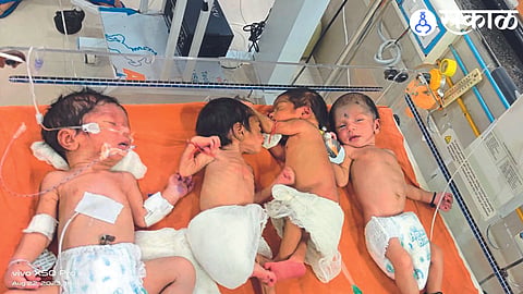 Malnourished children under treatment at District Hospital.