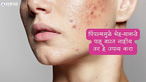 Face Care Tips