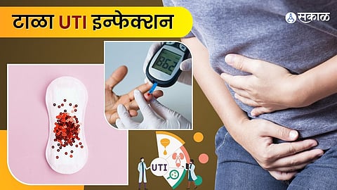 असा टाळा मूत्रसंसर्ग