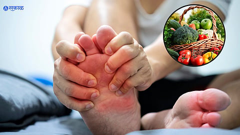 Uric Acid Control Tips
