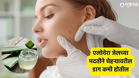 Aloe vera gel Skincare tips
