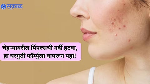 Face Care Tips