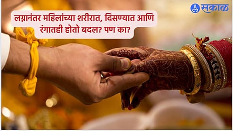 Women Health