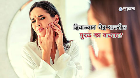 Skin Care Tips