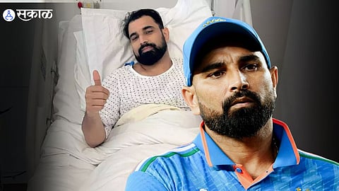 Mohammed Shami Injury Update : लंडनमधील उपचारानंतर.... बीसीसीआयने मोहम्मद शमीच्या दुखापतीवर दिली मोठी अपडेट