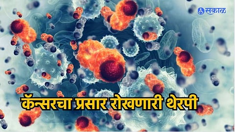 Cancer Therapy