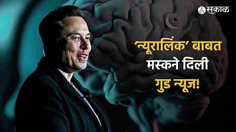 Neuralink Brain Chip