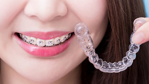 Dentition Diarrhea