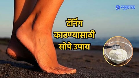 Tanning Removal Tips