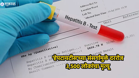 Hepatitis