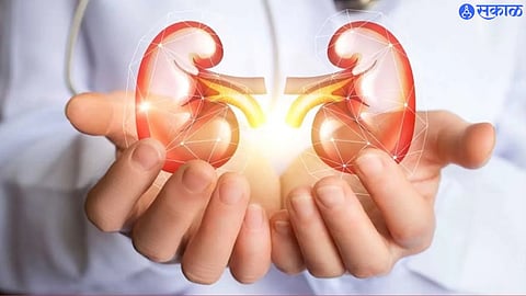kidney donate