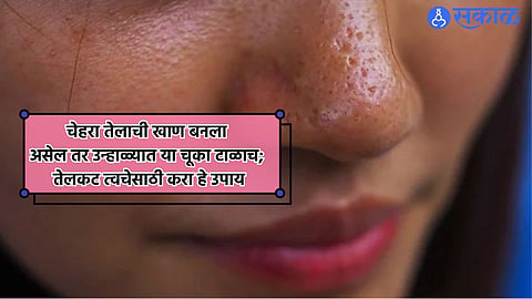 Oily Skin Care