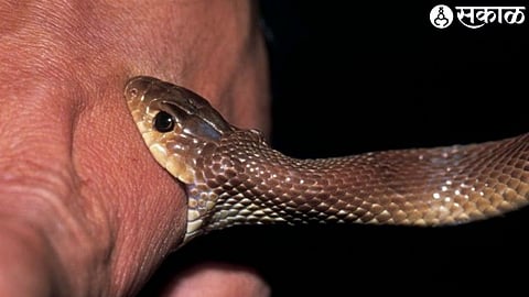 Snake Bite