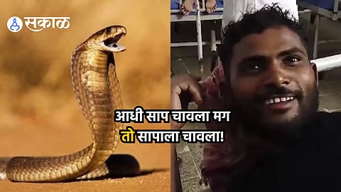 Snake Bite