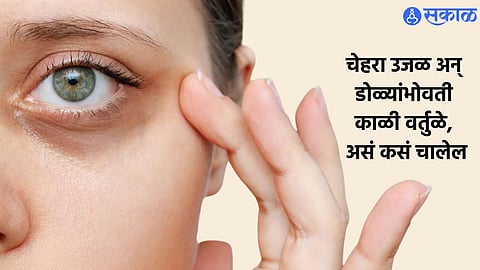 Beauty Tips Dark Circles Remedies
