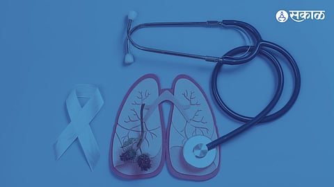 World Lung Cancer Day 2024