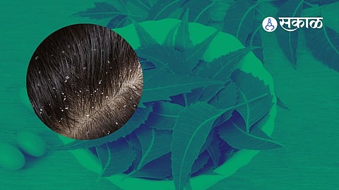 Hair Fall Problem