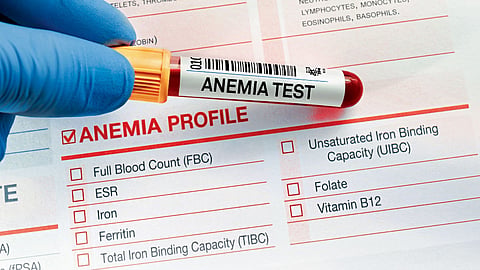 Anemia Test