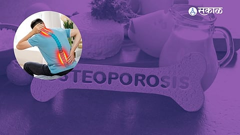 World Osteoporosis Day 2024