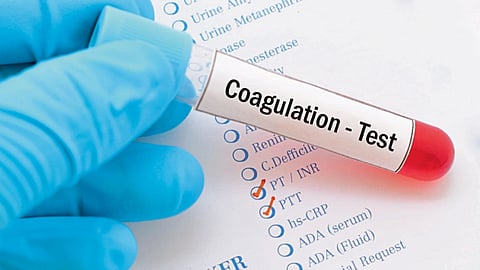 Coagulation Test