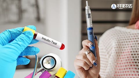 Insulin Resistance