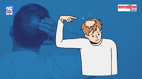 Baldness Solutions