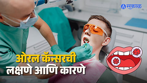 Common Symptoms of Oral Cancer