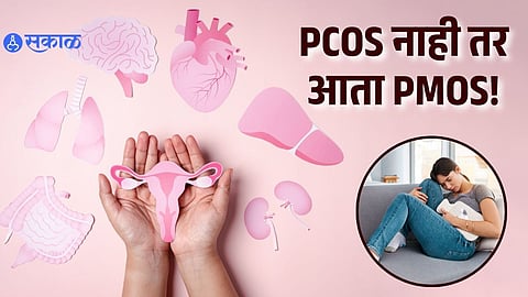 Why PCOS Is Now Being Called PMOS? The Big Change In Women’s Hormonal Health