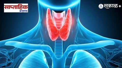 Thyroid Management and Treatment
