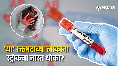 A new scientific study suggests certain blood groups, especially type A, may have a higher risk of early stroke.