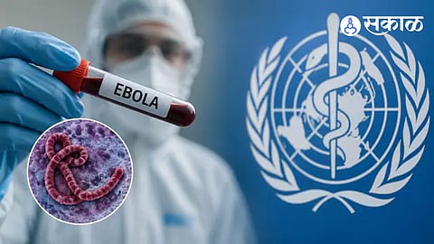 Ebola Virus in Mumbai