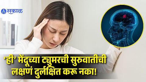 Brain Tumor Early Symptoms No One Should Ignore
