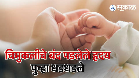4 months old child got new life