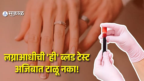 Premarital Blood Test That Could Protect Your Future Child From Genetic Disorders