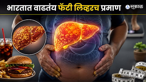 Increased Cases Of Fatty Liver In India