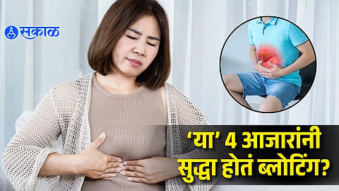 Person experiencing stomach bloating with digestive health illustration highlighting possible medical conditions