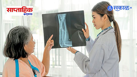 Premium|Osteoporosis Prevention : ऑस्टिओपोरोसिसचा वाढता धोका; चाळिशीनंतर हाडे मजबूत ठेवण्यासाठी काय कराल?
