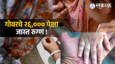 Measles Cases