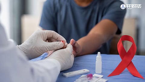 Karnataka HIV case