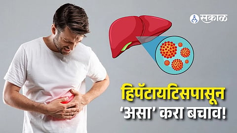 Monsoon Alert: Hepatitis A and E Infections Increase by 20%, Here's How to Stay Safe