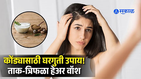 Hair Care Tips for Dandruff | Ayurvedic Home Remedies