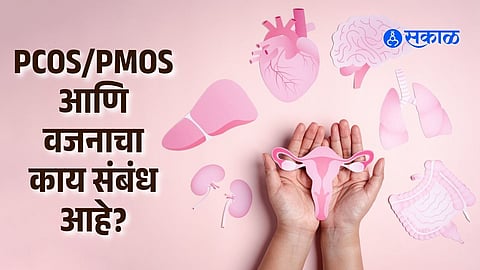 PCOS/PMOS and Body Weight Connection
