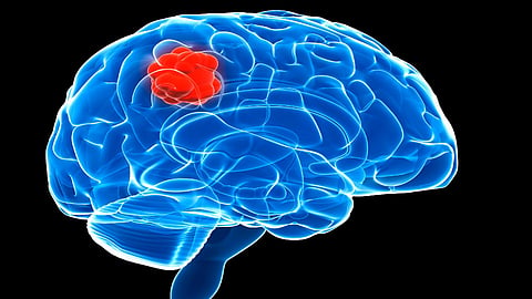 Brain tumor surgery without opening brain