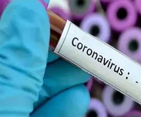 corona positive