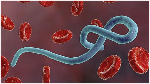 ebola.